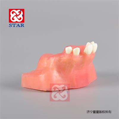 種植切開(kāi)縫合練習可用超聲骨刀練習仿骨質(zhì)