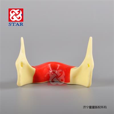 整體硬塑脂缺牙區填充仿骨質(zhì)定位練習
